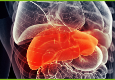 Fatty Liver and What to Do About It